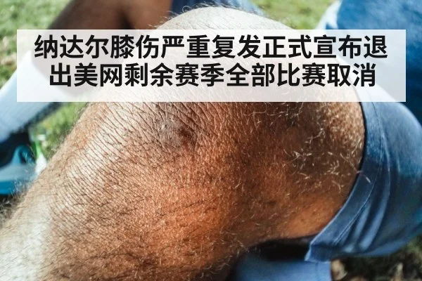 纳达尔膝伤严重复发正式宣布退出美网剩余赛季全部比赛取消